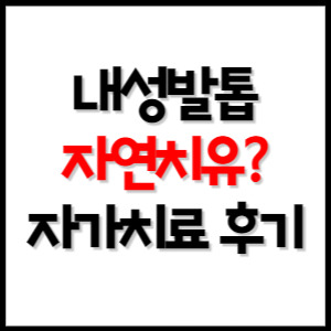 내성발톱 자연치유 가능할까? 내성발톱 자가치료 후기 :: Tv조선 쇼퀸 투표하기
