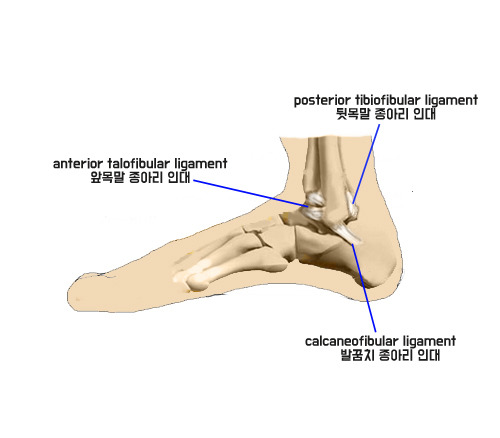뻐근하고 시큰거리는 발목 통증이 계속된다면?