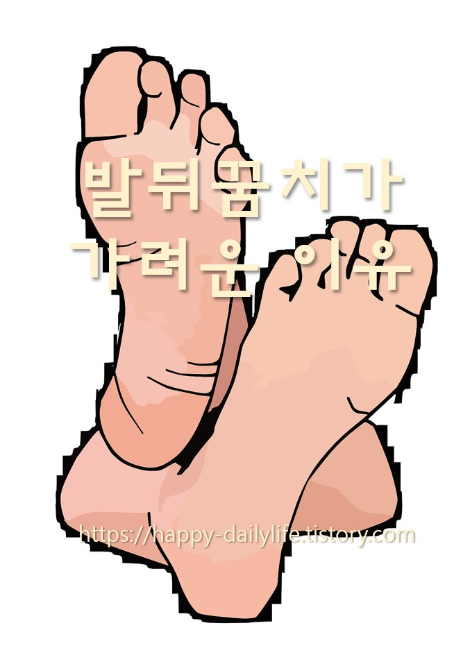 발뒤꿈치 가려움으로 해결 6