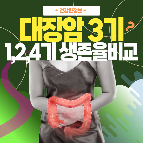대장암 3기 생존율 | 1기, 2기, 4기 생존율 비교