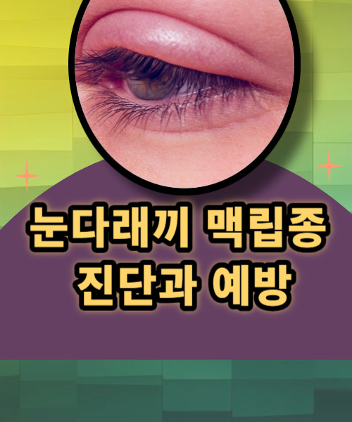 눈다래끼 맥립종 눈 퉁퉁 붙고 주변이 욱신거리거나 고름 같은게 생겼다면 감염치료 받아야해요
