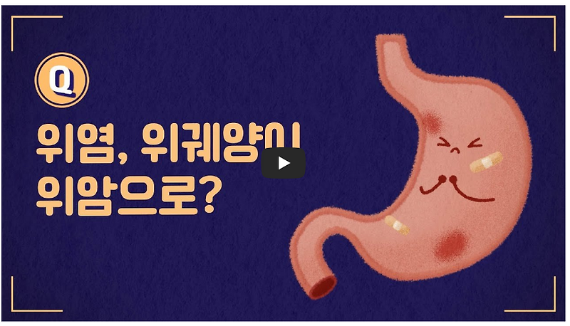 위염 증상과 위궤양 증상 차이 알아보기