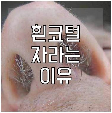 흰코털 나는 이유 및 뽑으면 위험한 이유