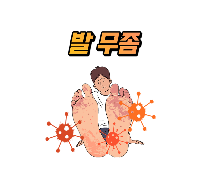 발톱, 발가락, 발바닥 무좀 원인과 유형별 증상