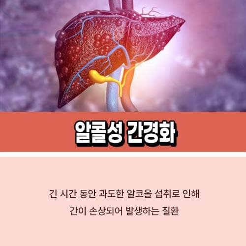 알콜성 간질환 간경화 증상 치료법 좋은 음식 7가지 1579