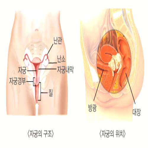 관계후 배묵직 통증이 있는 이유 3가지