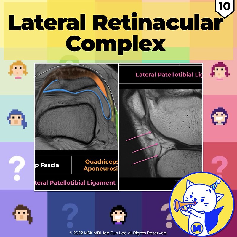 (Fig 4-A.10) Lateral Retinacular Complex