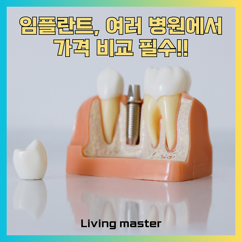 임플란트 가격, 이것까지 물어보세요! 여러 병원 상담 통한 현명한 가격 비교법
