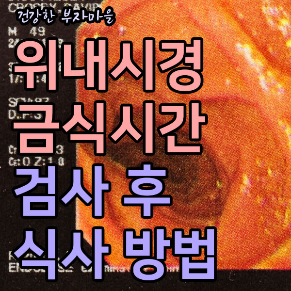 위내시경 금식시간, 전날 음식, 물 feat. 위내시경 후 식사 방법