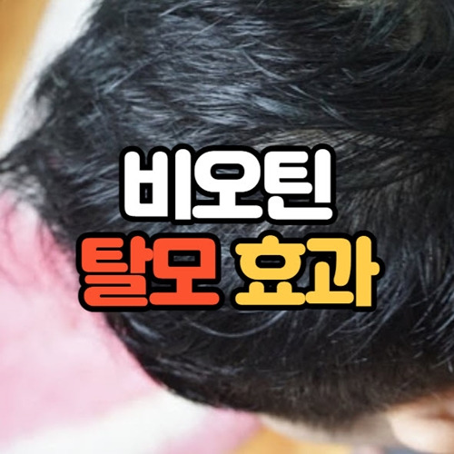 비오틴 탈모 효과 및 후기