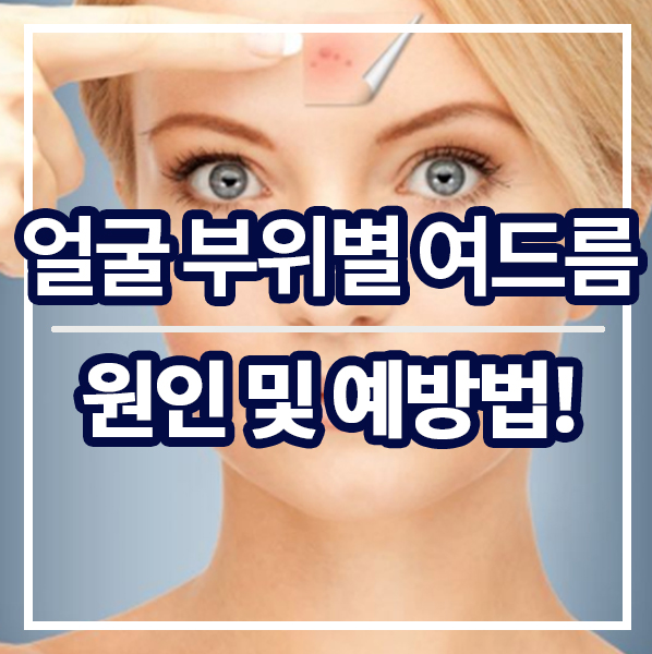 [얼굴 부위별 여드름 원인 및 예방법] 볼, 코, 턱, 관자놀이, 미간, 이마