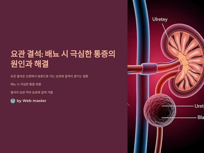 요관 결석 배뇨 시 극심한 통증: 원인과 해결 방법
