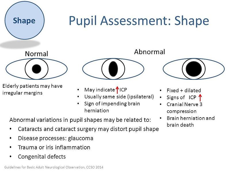 normal pupil size mm