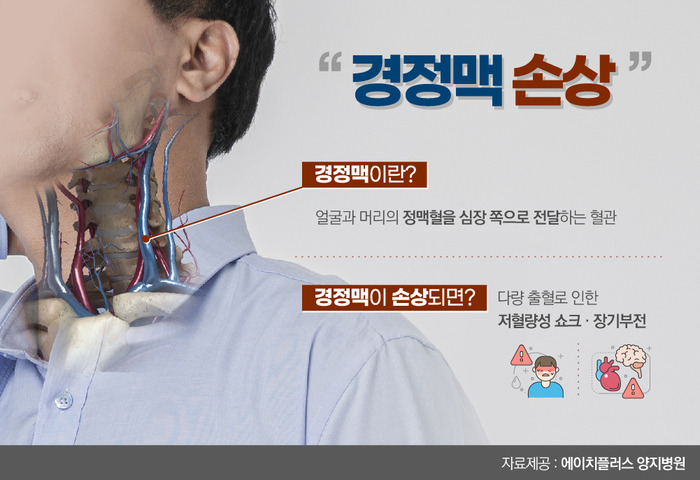 열상 자상 뜻은 무엇일까? 경정맥이란?