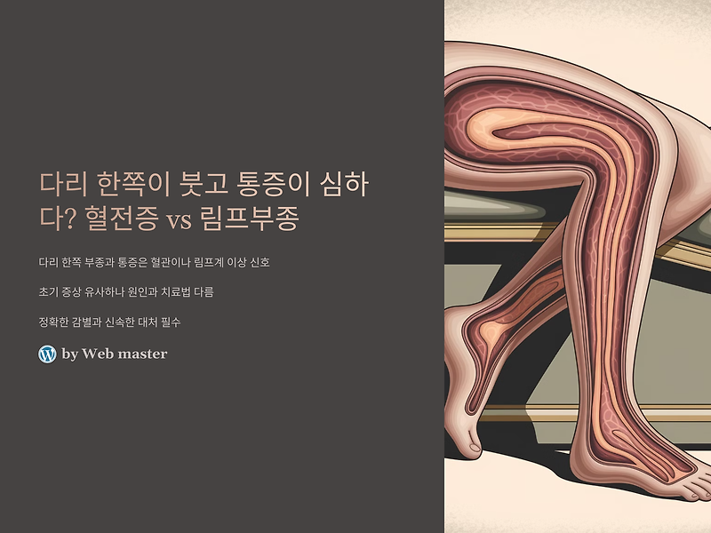 다리 한쪽이 붓고 통증이 심하다? 혈전증 vs 림프부종 차이점과 대처법