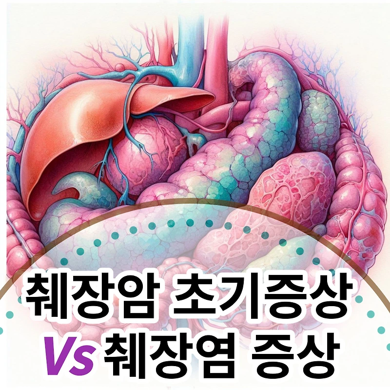 췌장암 초기 증상 vs 췌장염 증상