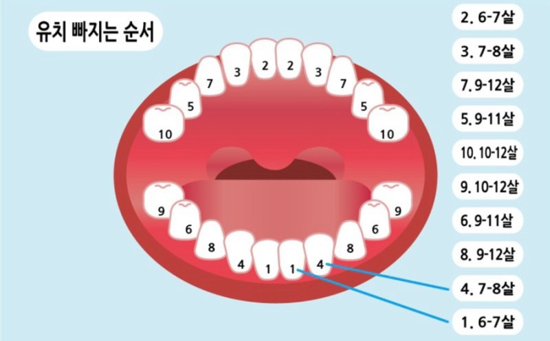 유치 빠지는 순서와 유치 빠지는 시기