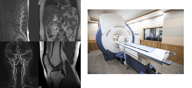 실비 및 실손보험 갱신 보장 내용 초음파MRI 급여비 급여 실비보험 갱신 비갱신 의료비 보험금 보장 현명하게 알아보기 10