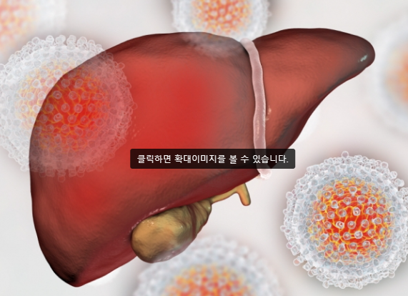 간염증상이란?