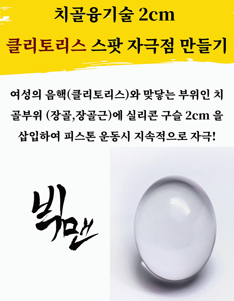 남성 실리콘보형물 종류 티링 구슬 해바라기링 치골 실전수술 후기