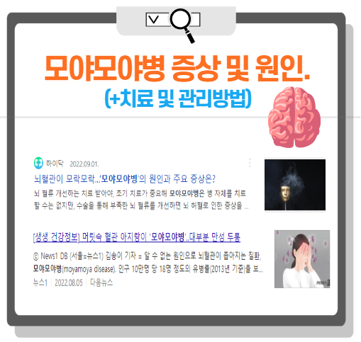 모아모아병 증상 및 원인 (+치료·관리법)