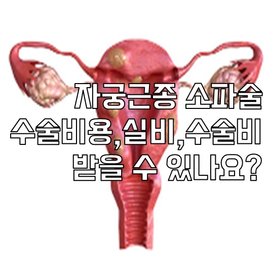 자궁근종 소파술 수술비용,실비,수술비 받을 수 있나요?