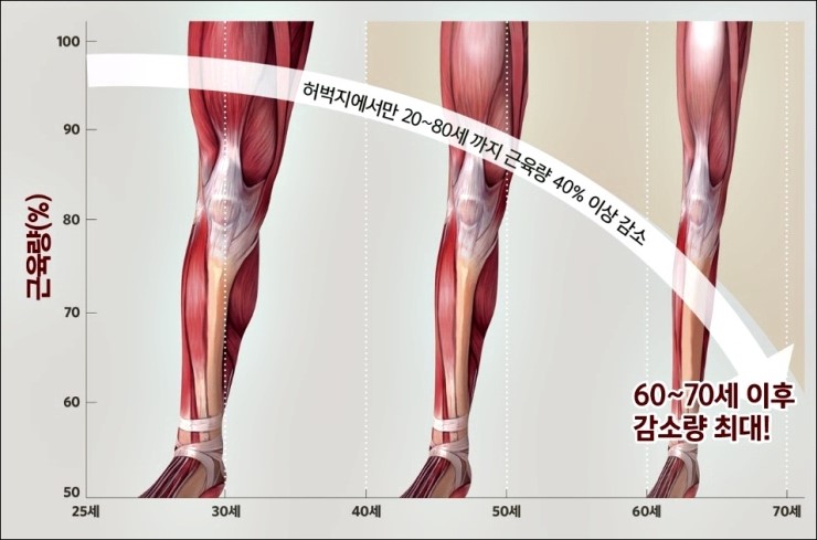 감소된 사용, 그리고 노화에 따른 근육에서의 변화들