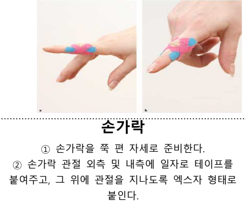 020. 테이핑 요법