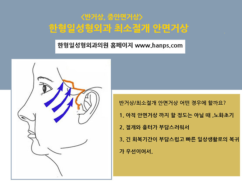 욕심만 덜 부린다면, 만족도 높은 반거상 추천하는 이유
