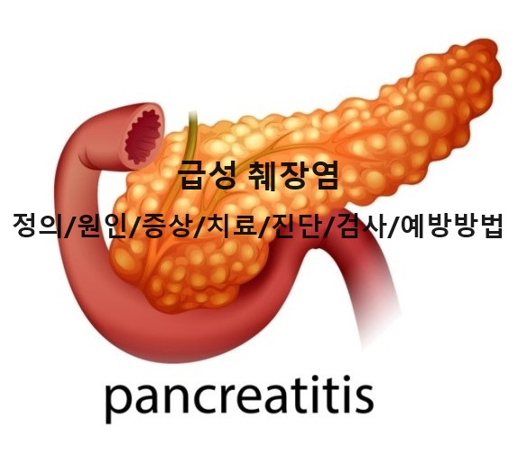 [건강이슈] 급성 췌장염 정의/원인/증상/진단/검사/치료방법/예방방법