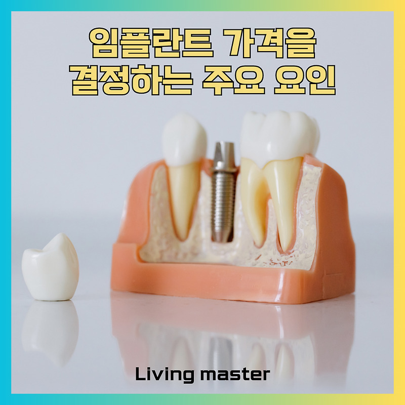 임플란트 가격, 천차만별인 이유? 임플란트 비용 결정하는 주요 요인 분석