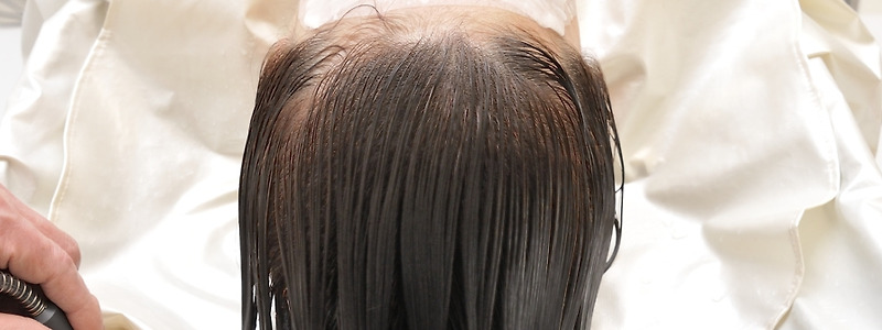 머리 숱을 늘리는데 도움되는 음식 그리고 식재료와 케어방법