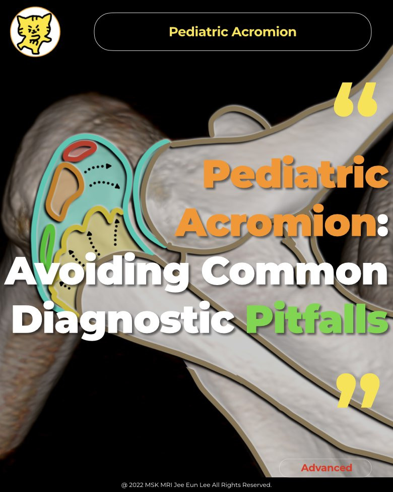  pediatric acromion avoiding common diagnostic pitfalls