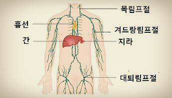 '림프절 부음' 원인과 대응