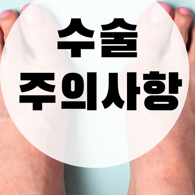 무지외반증 수술 비밀