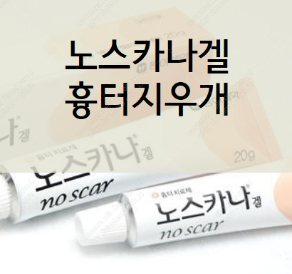 노스카나겔 정확히 알고 사용할 것!(노스카나겔 가격) :: 가오만사성