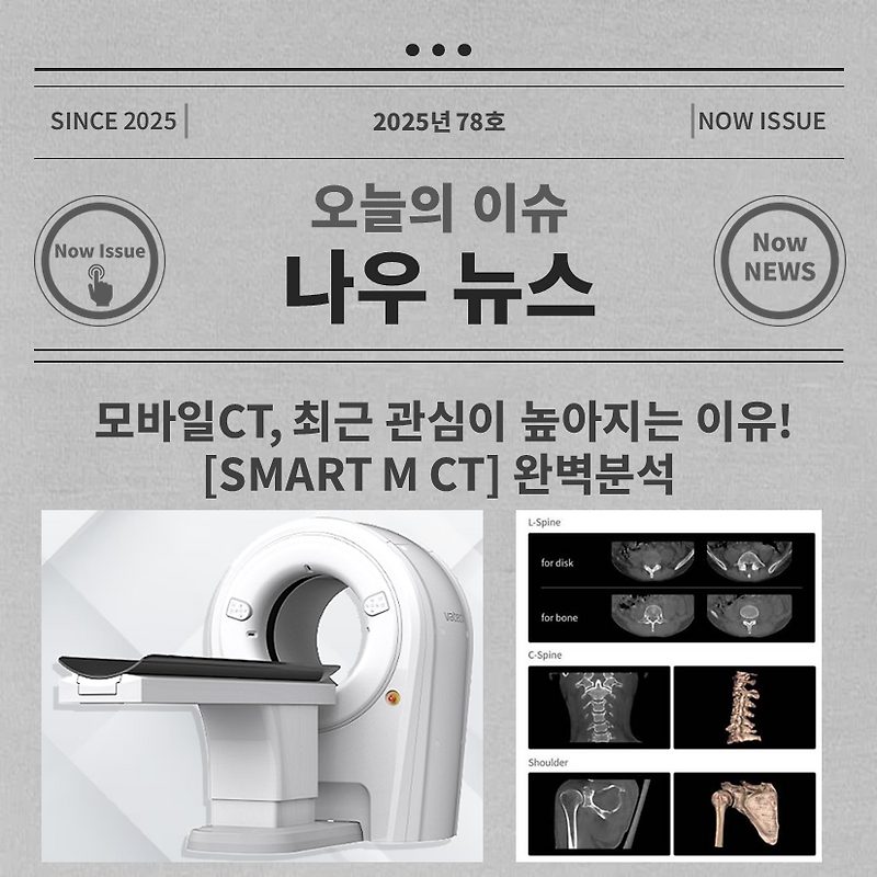 모바일CT, 최근 관심이 높아지는 이유! [SMART M CT] 완벽분석