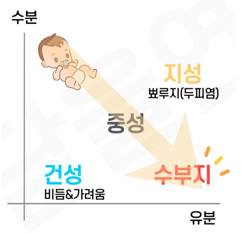 지성두피, 건성두피 구분 어떻게 하죠? 내 두피타입 찾는 법