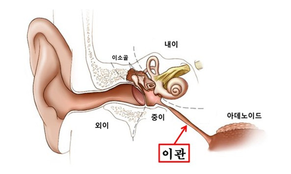 아이유가 걸린 이관개방증 증상, 원인, 치료