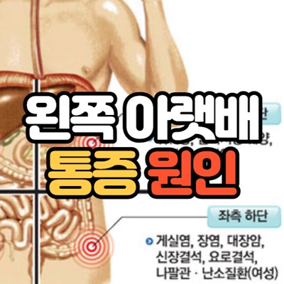 남자 왼쪽 아랫배 통증 원인 6가지