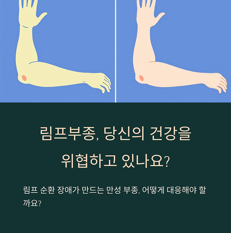 림프부종, 부기에서 수술까지: 조기 진단과 치료 전략