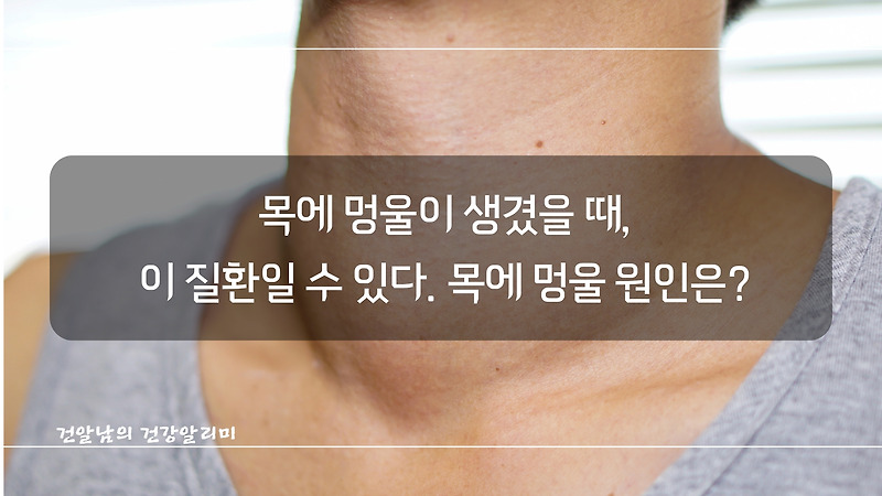 목에 멍울이 생겼을 때, 목에 멍울 증상! 목 멍울의 원인은?