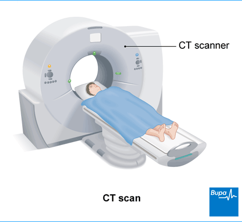영상검사 > CT & MRI &MRA 차이