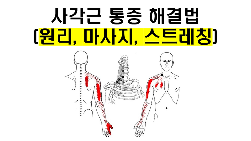 사각근과 통증