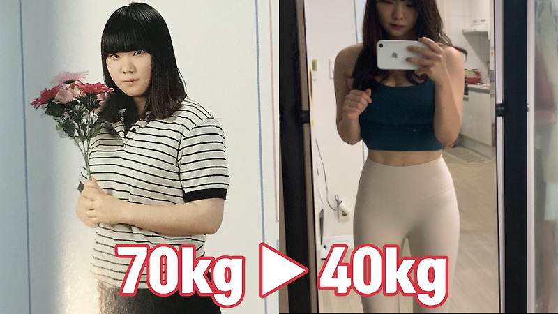 30kg 감량(70kg->40kg)! 일반인 다이어트 전후 사진, 현실적인 다이어트 리얼 후기, 식이장애 이야기 (1/2) :: 요망 생활정보” style=”width:100%”><figcaption>30kg 감량(70kg->40kg)! 일반인 다이어트 전후 사진, 현실적인 다이어트 리얼 후기, 식이장애 이야기 (1/2) :: 요망 생활정보</figcaption></figure>
<p style=