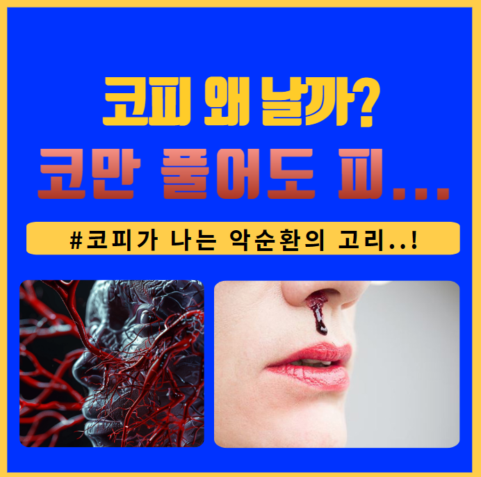코풀면 피나는 이유는 무엇일까? 코 건조증..?