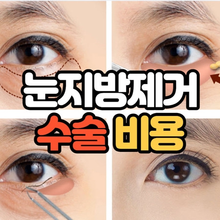눈밑지방제거수술비용 걱정 보다 중요한 부분은? 5