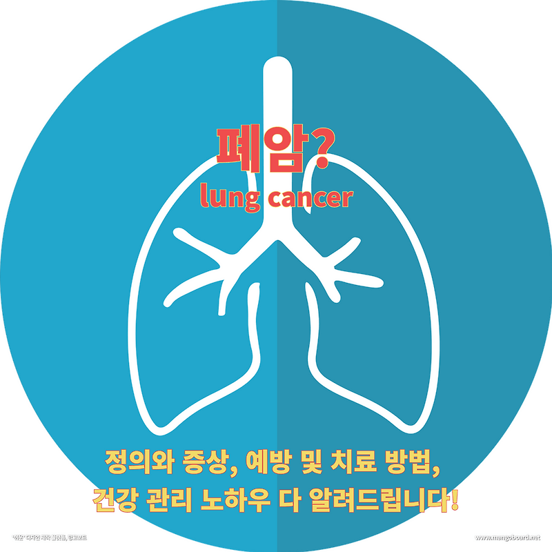 건강 폐암 증상과 치료 방법