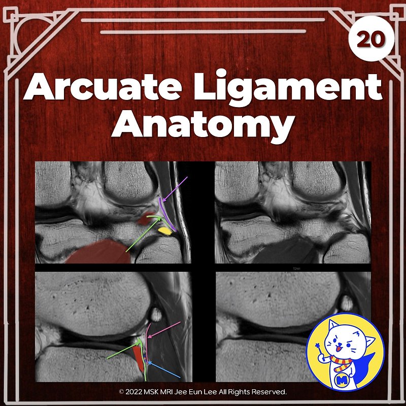 (Fig 3-B.20) Arcuate Ligament Anatomy