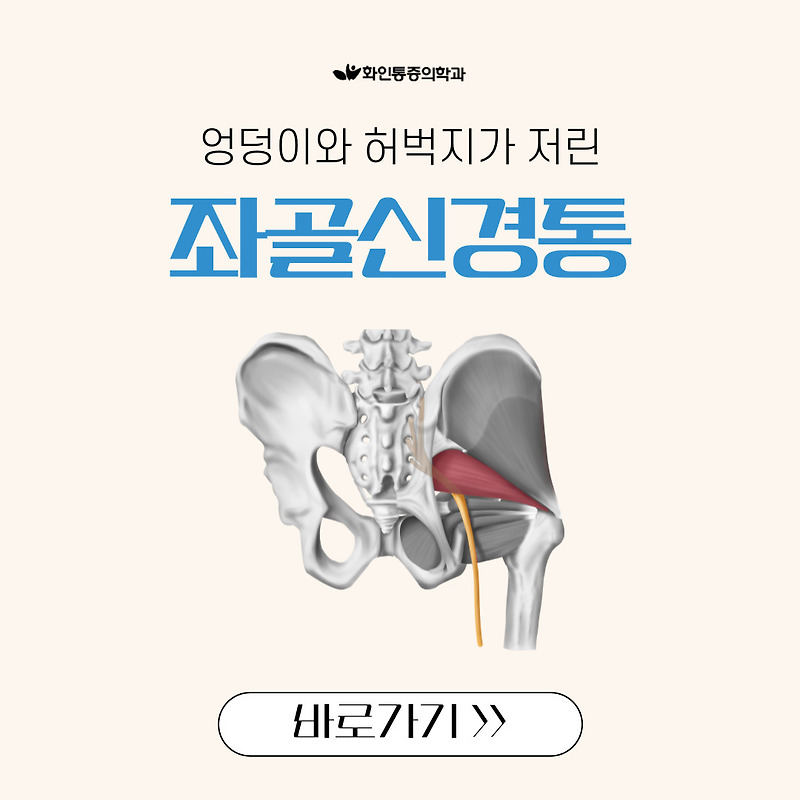 울산역근처병원 좌골신경통으로 엉덩이저림이 있다면